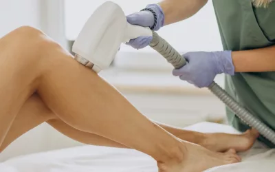 Sun and permanent hair removal: what you need to know